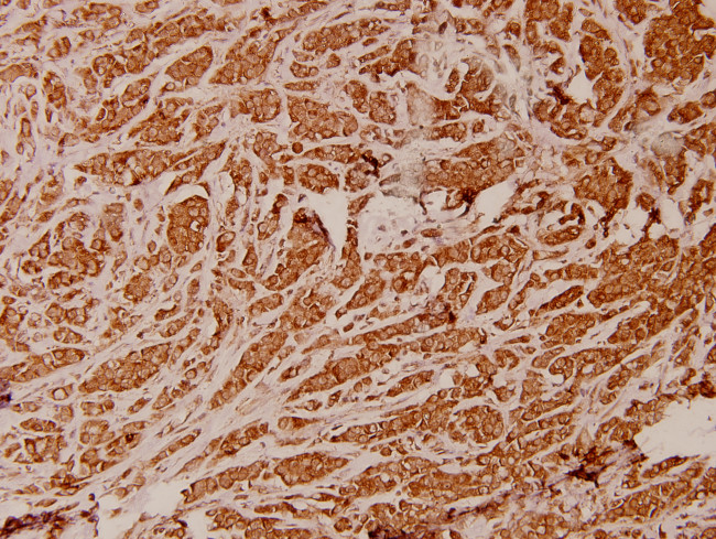 ATP5I Antibody in Immunohistochemistry (Paraffin) (IHC (P))