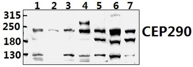 CEP290 Antibody in Western Blot (WB)
