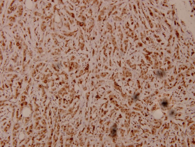 PEX7 Antibody in Immunohistochemistry (Paraffin) (IHC (P))