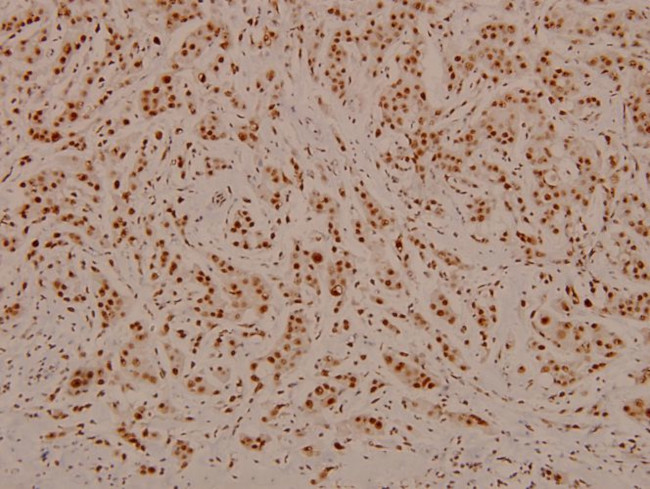 Phospho-C/EBP beta (Thr188, Thr235) Antibody in Immunohistochemistry (Paraffin) (IHC (P))