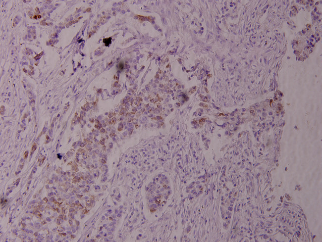 Phospho-TPL2 (Thr290) Antibody in Immunohistochemistry (Paraffin) (IHC (P))