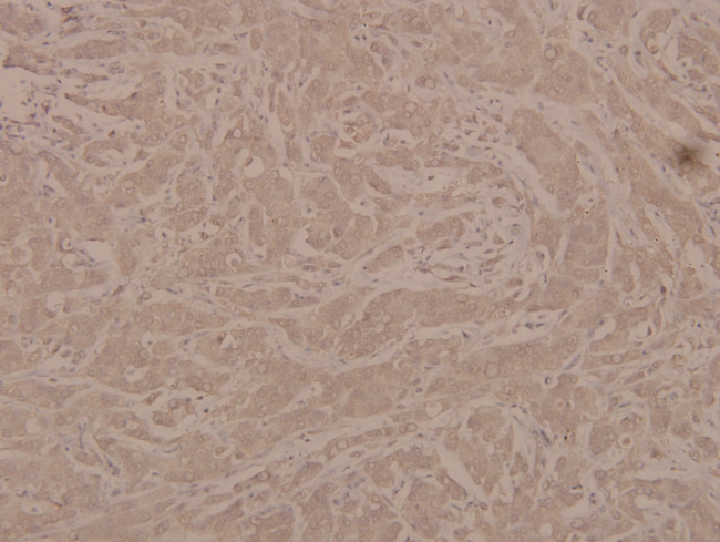 Phospho-G3BP1 (Ser232) Antibody in Immunohistochemistry (Paraffin) (IHC (P))