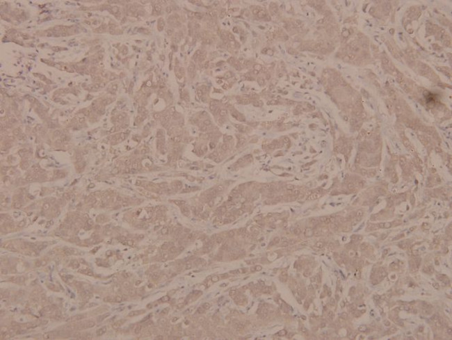 Phospho-G3BP1 (Ser232) Antibody in Immunohistochemistry (Paraffin) (IHC (P))