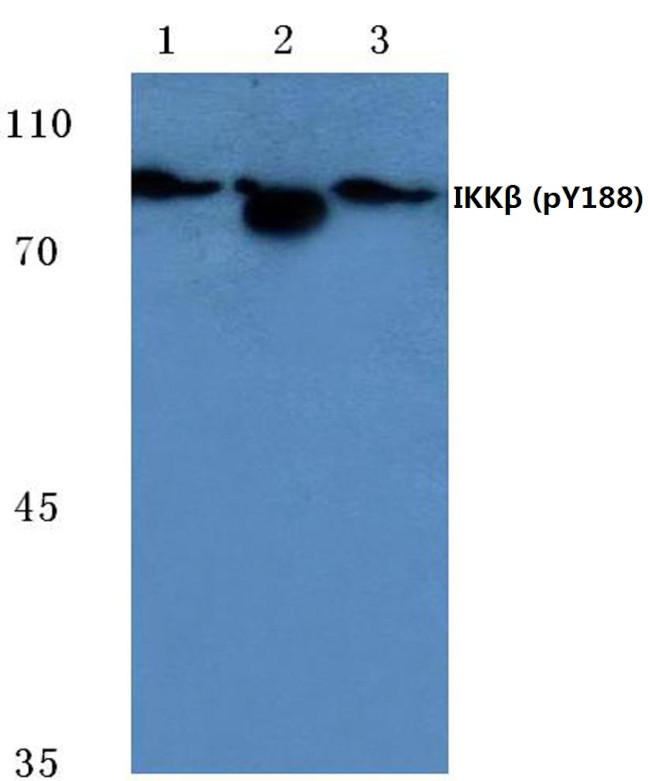 Phospho-IKK beta (Tyr188) Polyclonal Antibody (PA5-36653)