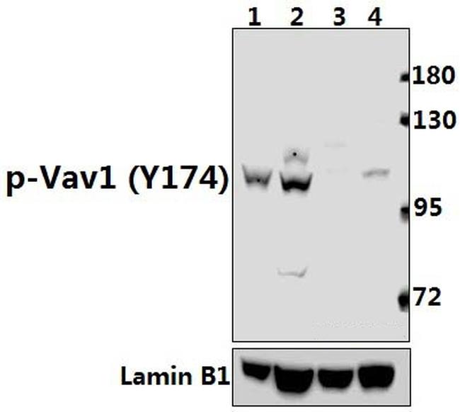 Phospho-VAV1 (Tyr174) Antibody in Western Blot (WB)