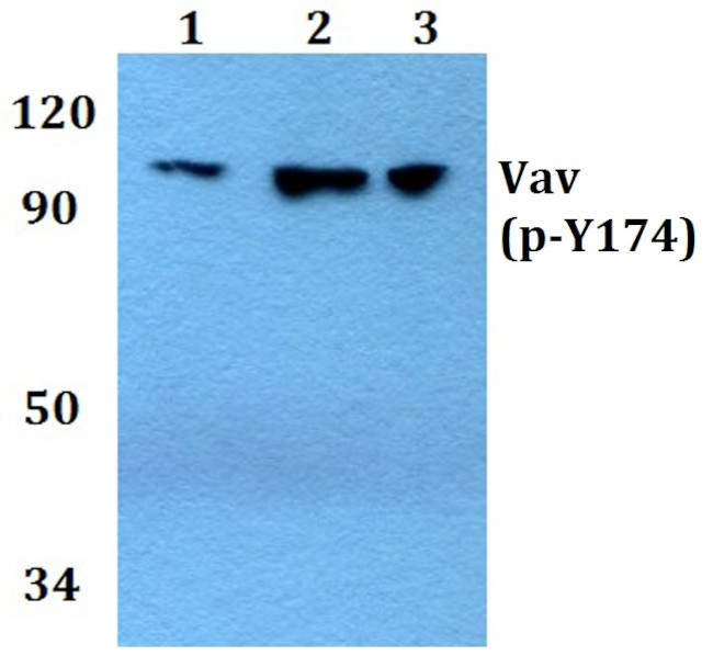 Phospho-VAV1 (Tyr174) Antibody in Western Blot (WB)