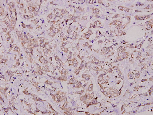 Phospho-Cdc25A (Ser76) Antibody in Immunohistochemistry (Paraffin) (IHC (P))