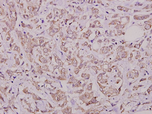 Phospho-Cdc25A (Ser76) Antibody in Immunohistochemistry (Paraffin) (IHC (P))