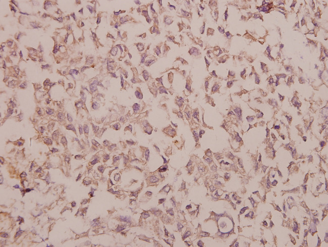 Phospho-IKK alpha/beta (Ser180, Ser181) Antibody in Immunohistochemistry (Paraffin) (IHC (P))