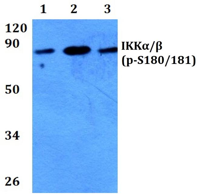 Phospho-IKK alpha/beta (Ser180, Ser181) Antibody in Western Blot (WB)