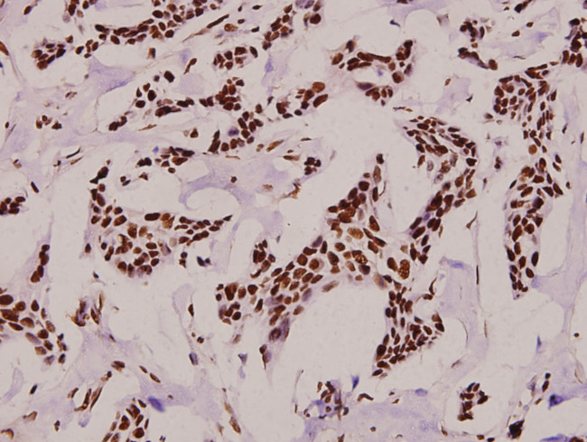 Phospho-POLR2A (Ser1619) Antibody in Immunohistochemistry (Paraffin) (IHC (P))