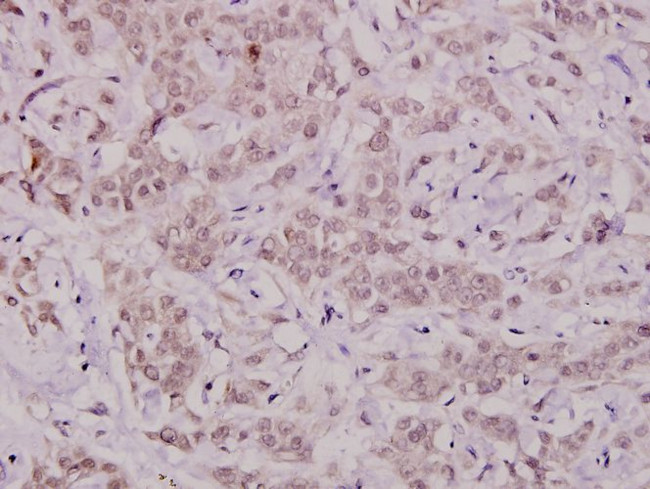 Phospho-Bcl-X (Thr47) Antibody in Immunohistochemistry (Paraffin) (IHC (P))