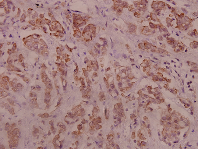 Phospho-IRS1 (Ser794) Antibody in Immunohistochemistry (Paraffin) (IHC (P))