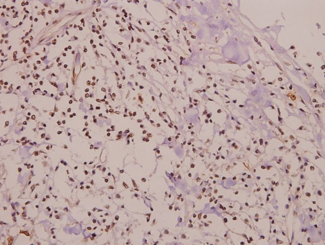 Phospho-SMAD1 (Ser465) Antibody in Immunohistochemistry (Paraffin) (IHC (P))