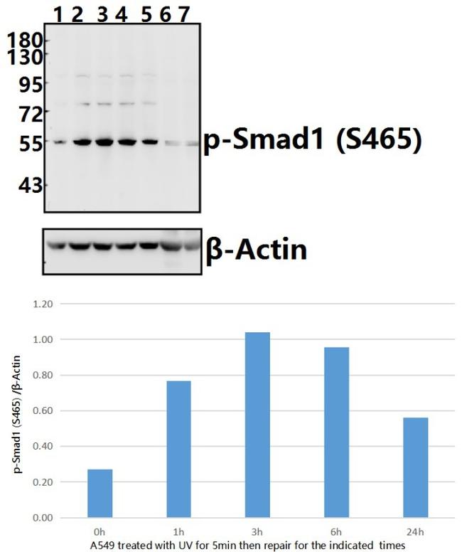 Phospho-SMAD1 (Ser465) Antibody in Western Blot (WB)