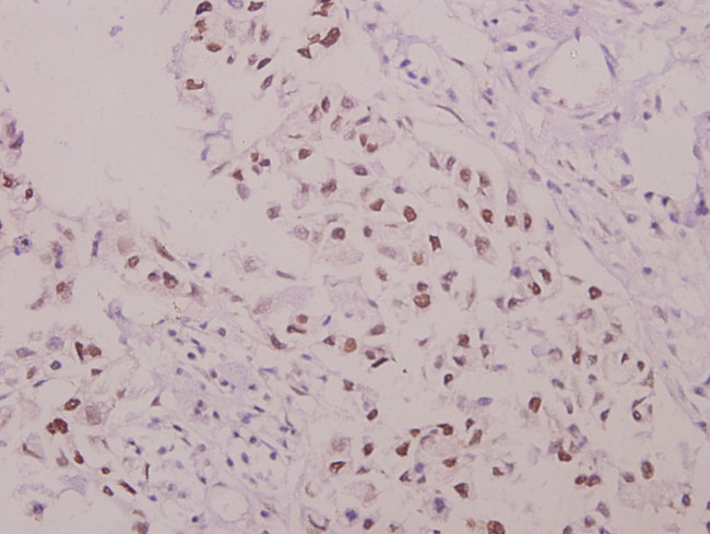 Phospho-p47phox (Ser304) Antibody in Immunohistochemistry (Paraffin) (IHC (P))