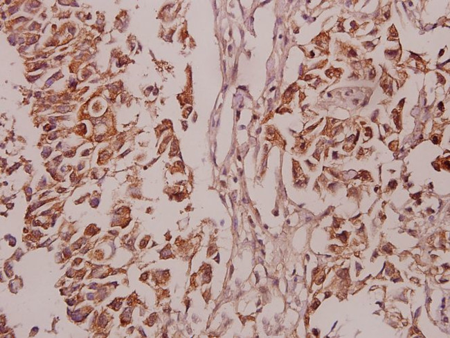 Phospho-PKC delta (Ser645) Antibody in Immunohistochemistry (Paraffin) (IHC (P))