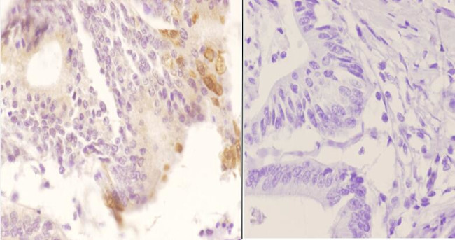 Phospho-Cytokeratin 8 (Ser74) Antibody in Immunohistochemistry (Paraffin) (IHC (P))