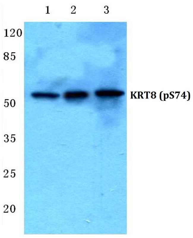 Phospho-Cytokeratin 8 (Ser74) Antibody in Western Blot (WB)