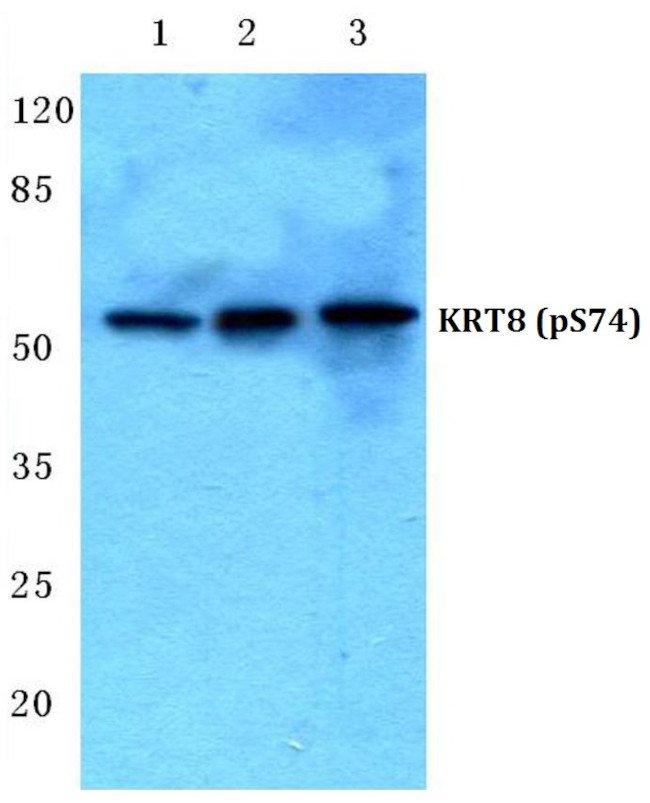 Phospho-Cytokeratin 8 (Ser74) Antibody in Western Blot (WB)