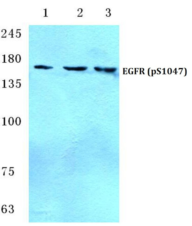 Phospho-EGFR (Ser1047) Antibody in Western Blot (WB)