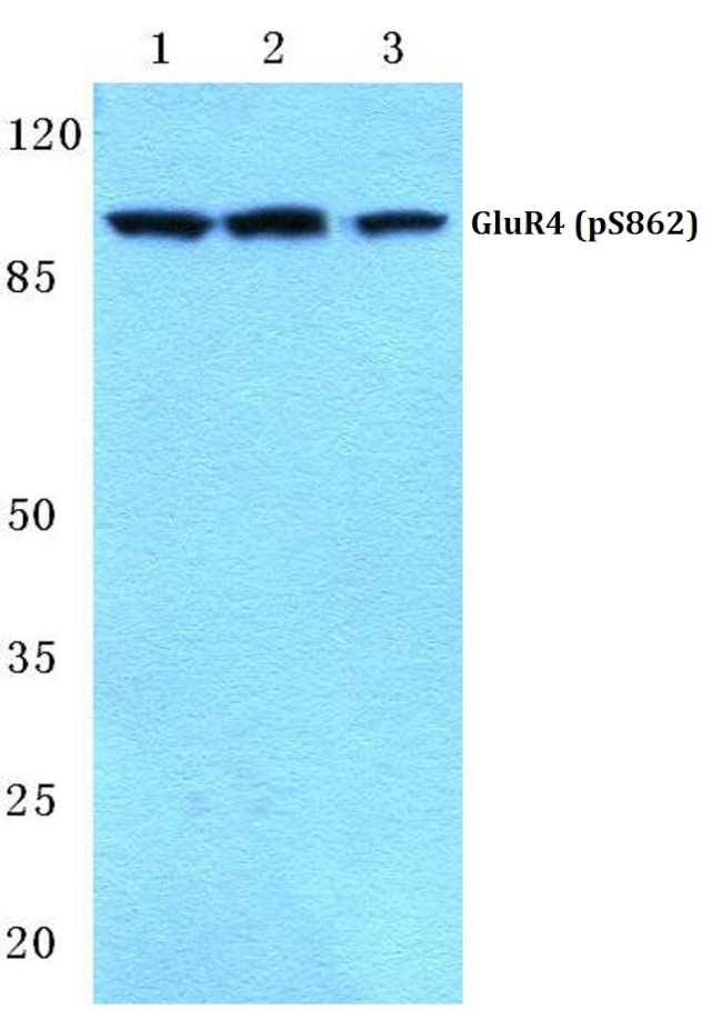 Phospho-GluR4 (Ser862) Antibody in Western Blot (WB)