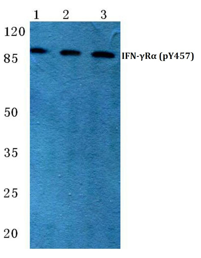 Phospho-IFNGR1 (Tyr457) Antibody in Western Blot (WB)