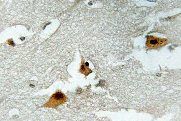 Phospho-FOXO4 (Ser197) Antibody in Immunohistochemistry (Paraffin) (IHC (P))