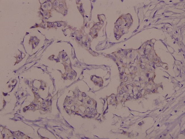 Phospho-Zap-70 (Tyr319) Antibody in Immunohistochemistry (Paraffin) (IHC (P))