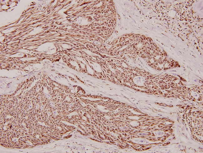 Phospho-beta Catenin (Ser37) Antibody in Immunohistochemistry (Paraffin) (IHC (P))