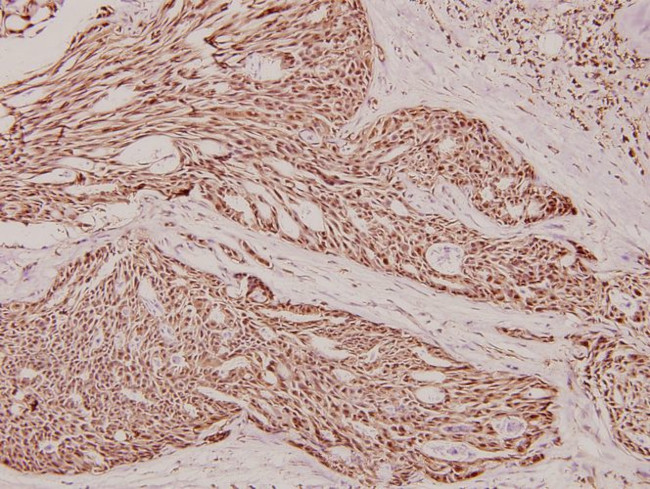 Phospho-beta Catenin (Ser37) Antibody in Immunohistochemistry (Paraffin) (IHC (P))