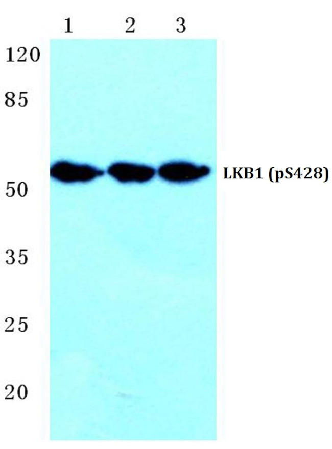 Phospho-LKB1 (Ser428) Antibody in Western Blot (WB)