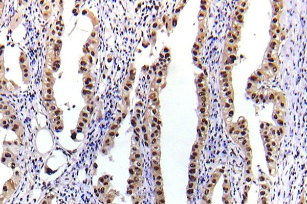 Phospho-STAT5 alpha (Ser780) Antibody in Immunohistochemistry (Paraffin) (IHC (P))