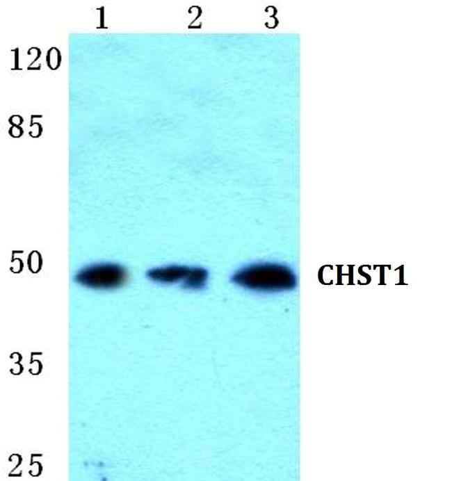 CHST1 Antibody in Western Blot (WB)