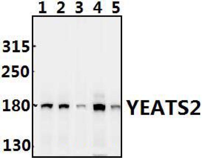 YEATS2 Antibody in Western Blot (WB)