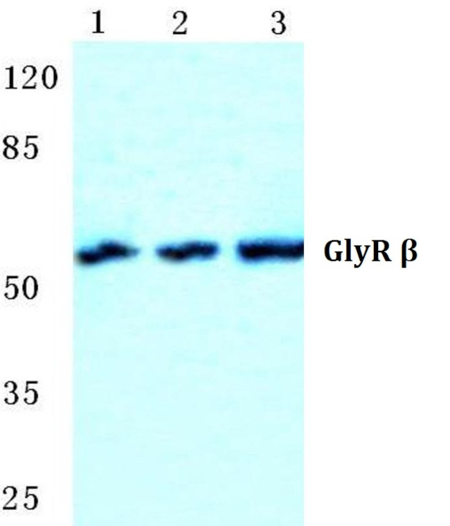 GLRB Antibody in Western Blot (WB)