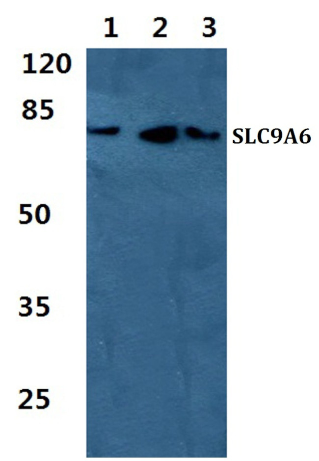 SLC9A6 Antibody in Western Blot (WB)