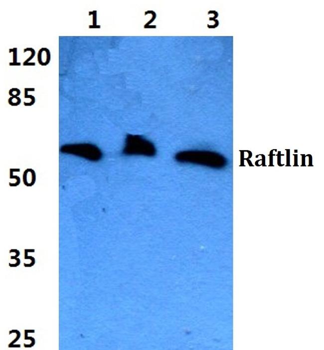 RFTN1 Antibody in Western Blot (WB)