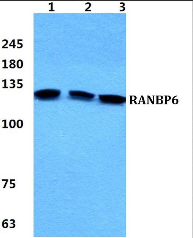 RANBP6 Antibody in Western Blot (WB)