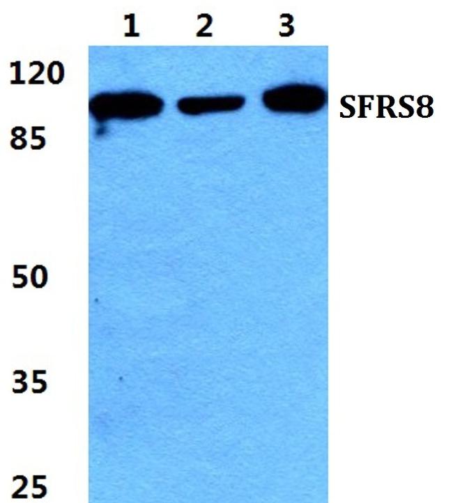 SFRS8 Antibody in Western Blot (WB)
