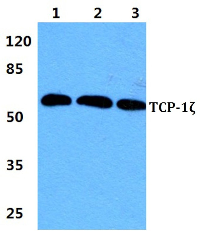 TCP-1 zeta Antibody in Western Blot (WB)