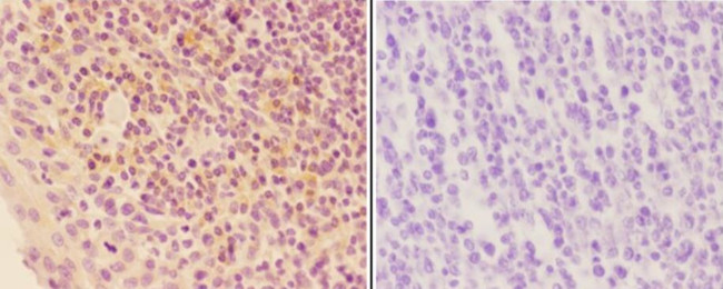 ORM2 Antibody in Immunohistochemistry (Paraffin) (IHC (P))