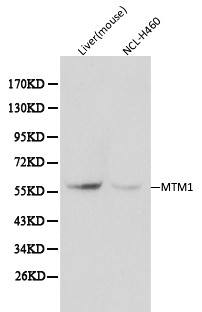 MTM1 Antibody in Western Blot (WB)