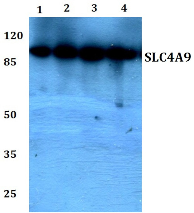 SLC4A9 Antibody in Western Blot (WB)