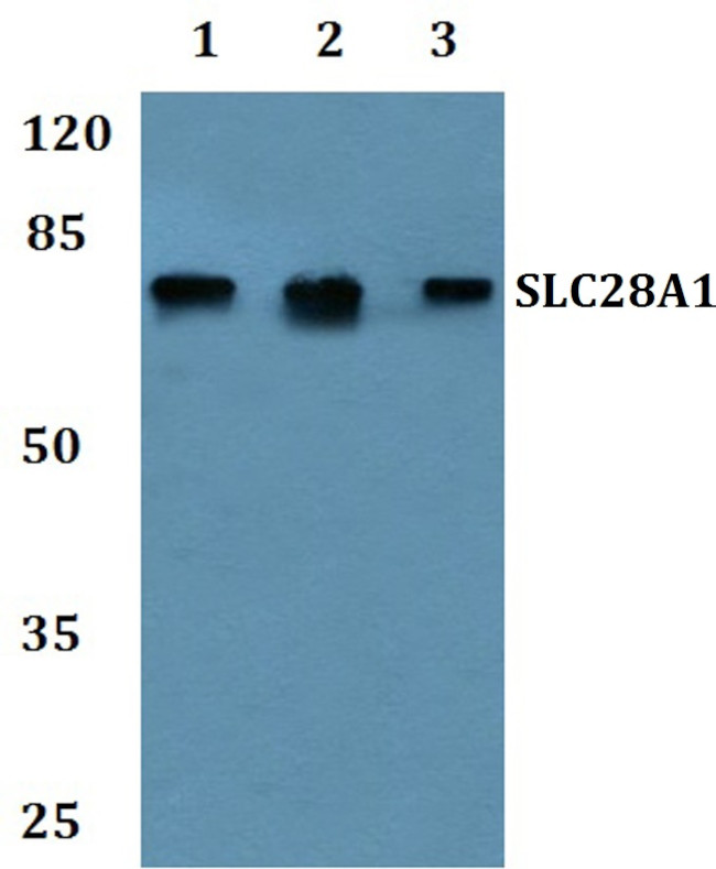 SLC28A1 Antibody in Western Blot (WB)