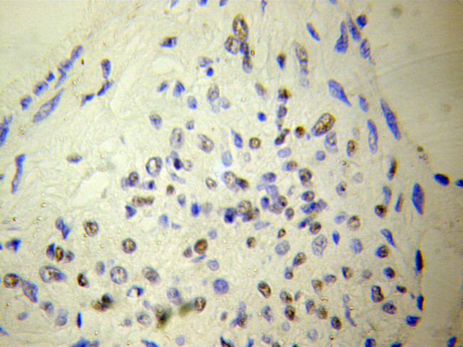 NUDT6 Antibody in Immunohistochemistry (Paraffin) (IHC (P))