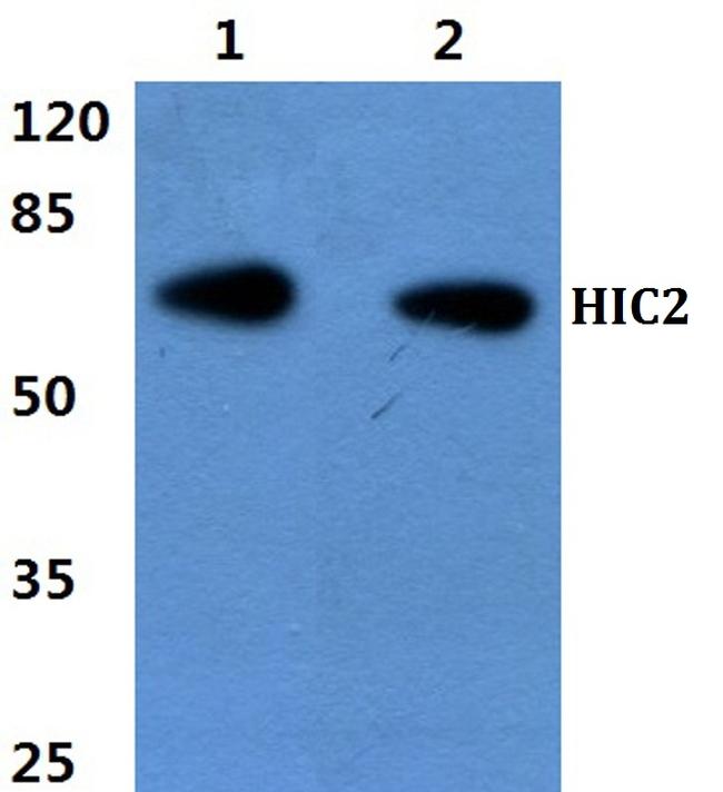 HIC2 Antibody in Western Blot (WB)