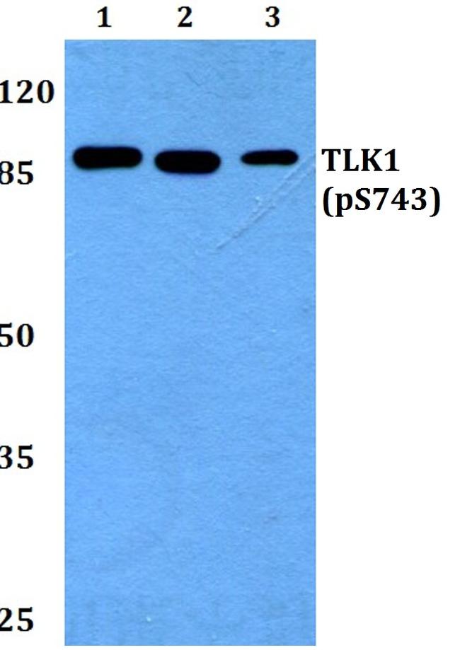 Phospho-TLK1 (Ser743) Antibody in Western Blot (WB)
