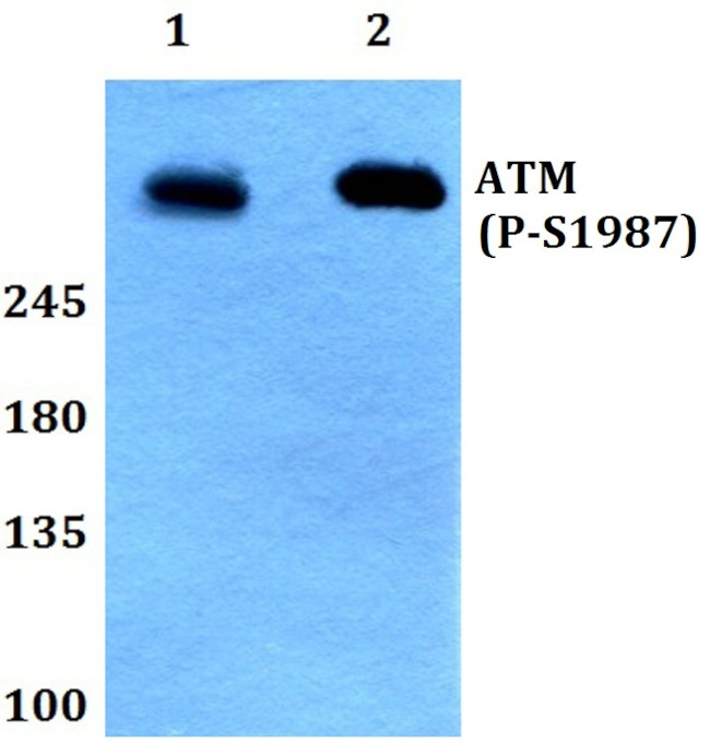 Phospho-ATM (Ser1987) Antibody in Western Blot (WB)