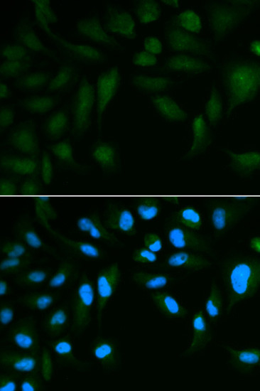 SPINLW1 Antibody in Immunocytochemistry (ICC/IF)